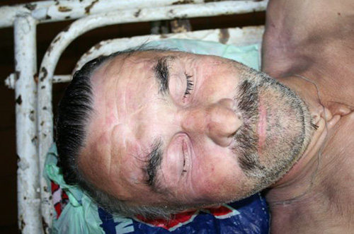 Полиция просит помощи в опознании трупа